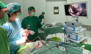 RSUD Brebes Kini Bisa Tangani Operasi Stroke Dengan Endoskopi